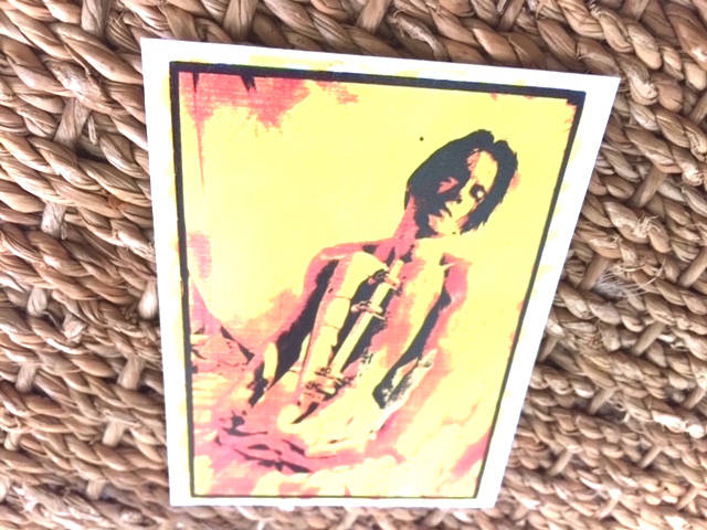 Gordon with fixator, post RTA